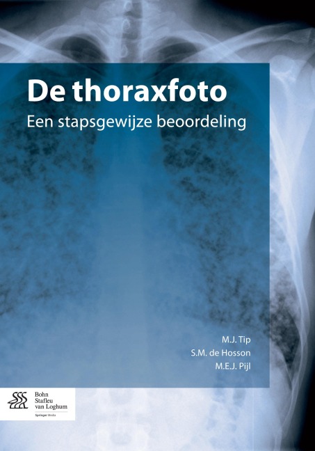 De thoraxfoto - 