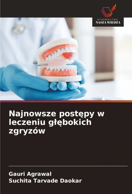 Najnowsze post¿py w leczeniu g¿¿bokich zgryzów - Gauri Agrawal, Suchita Tarvade Daokar