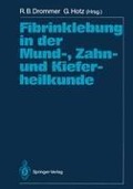 Fibrinklebung in der Mund-, Zahn- und Kieferheilkunde - 