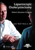 Laparoscopic Cholecystectomy - Patient Education - 