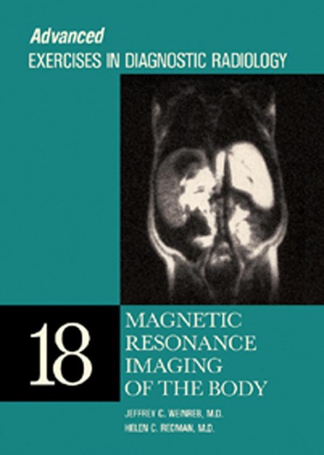 Magnetic Resonance Imaging of the Body - Jeffrey C. Weinreb, Helen C. Redman MD