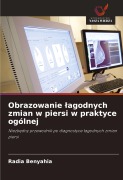 Cover-Bild zum Titel 'Obrazowanie ¿agodnych zmian w piersi w praktyce ogólnej' von 'Radia Benyahia'