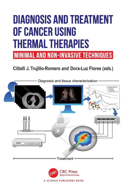Diagnosis and Treatment of Cancer using Thermal Therapies - 