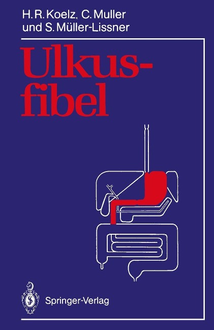 Ulkusfibel - Hans R. Koelz, Claude Muller, Stefan Müller-Lissner