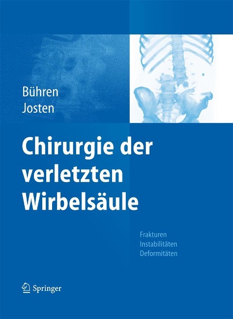 Chirurgie der verletzten Wirbelsäule - 