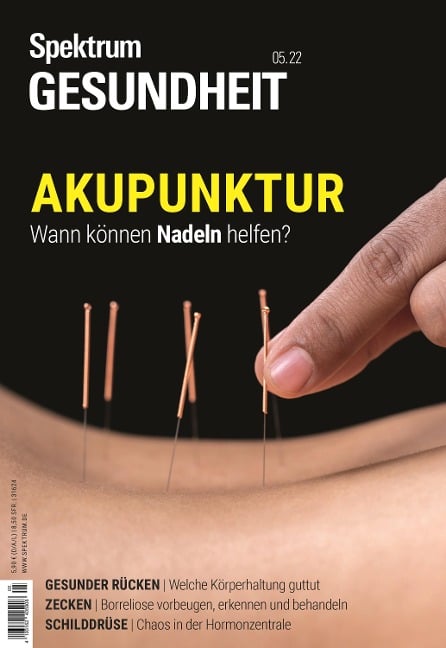 Spektrum Gesundheit- Akupunktur - Spektrum der Wissenschaft