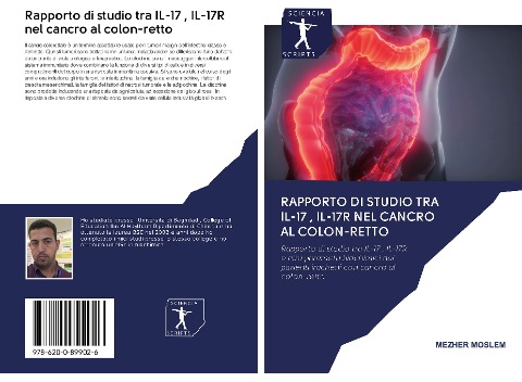 Rapporto di studio tra IL-17 , IL-17R nel cancro al colon-retto - Mezher Moslem