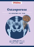 Apotheken Umschau: Osteoporose - 