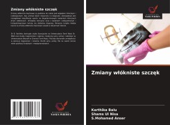 Cover-Bild zum Titel 'Zmiany w¿ókniste szcz¿k' von 'Karthika Balu, Shams Ul Nisa, S. Mohamed Anser'
