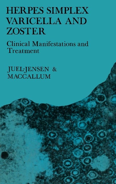 Herpes Simplex Varicella and Zoster - B. E. Juel-Jensen, F. O. Maccallum