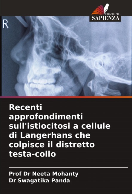 Recenti approfondimenti sull'istiocitosi a cellule di Langerhans che colpisce il distretto testa-collo - Neeta Mohanty, Swagatika Panda