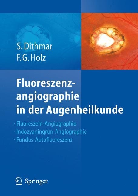 Fluoreszenzangiographie in der Augenheilkunde - Frank G. Holz, Stefan Dithmar
