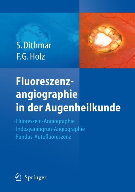 Fluoreszenzangiographie in der Augenheilkunde - Frank G. Holz, Stefan Dithmar
