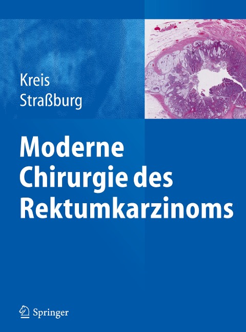 Moderne Chirurgie des Rektumkarzinoms - 