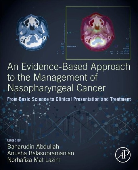 An Evidence-Based Approach to the Management of Nasopharyngeal Cancer - 
