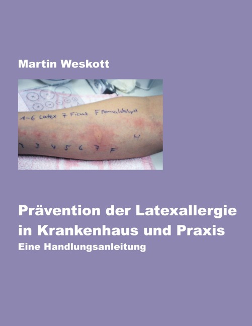 Prävention der Latexallergie in Krankenhaus und Praxis - Martin Weskott