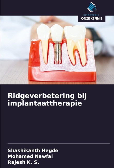 Ridgeverbetering bij implantaattherapie - Shashikanth Hegde, Mohamed Nawfal, Rajesh K. S.