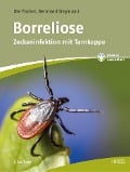 Cover-Bild zum Titel 'Borreliose' von 'Ute Fischer, Bernhard Siegmund'