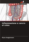 Cover-Bild zum Titel 'Infiammazione e cancro al colon' von 'Riyan Anggriawan'
