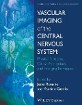 Vascular Imaging of the Central Nervous System - 