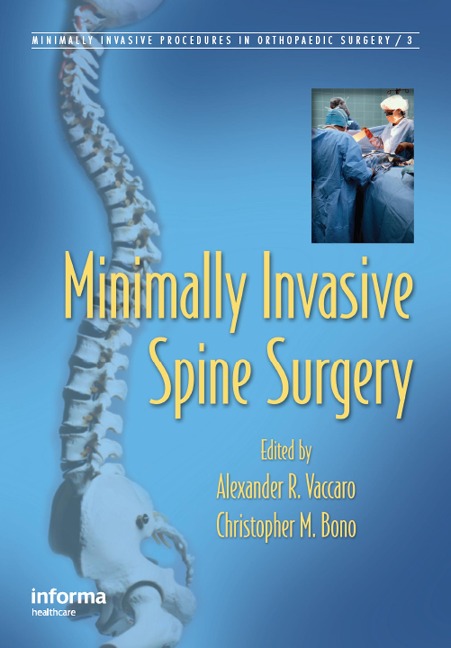 Minimally Invasive Spine Surgery - 