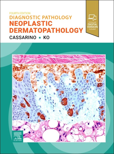 Diagnostic Pathology: Neoplastic Dermatopathology - David S Cassarino, Christine J Ko