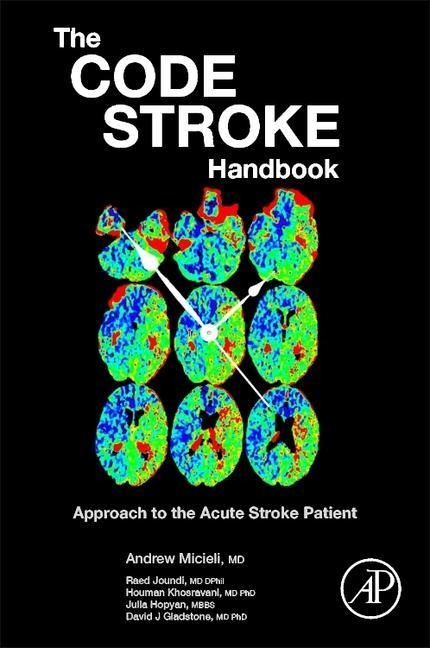 The Code Stroke Handbook - Andrew Micieli, David J. Gladstone, Julia Hopyan, Houman Khosravani, Raed Joundi