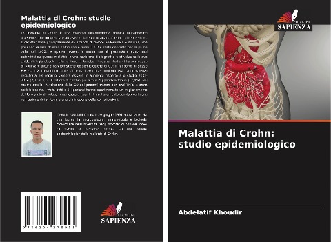 Malattia di Crohn: studio epidemiologico - Abdelatif Khoudir