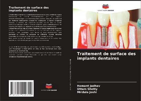 Traitement de surface des implants dentaires - Hemant Jadhav, Uttam Shetty, Mridula Joshi