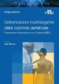 Cover-Bild zum Titel 'Deformazioni morfologiche della colonna vertebrale. Trattamento fisioterapico con il Metodo RPG' von 'Philippe E. Souchard'