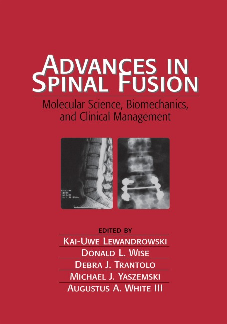 Advances in Spinal Fusion - Kai-Uwe Lewandrowski