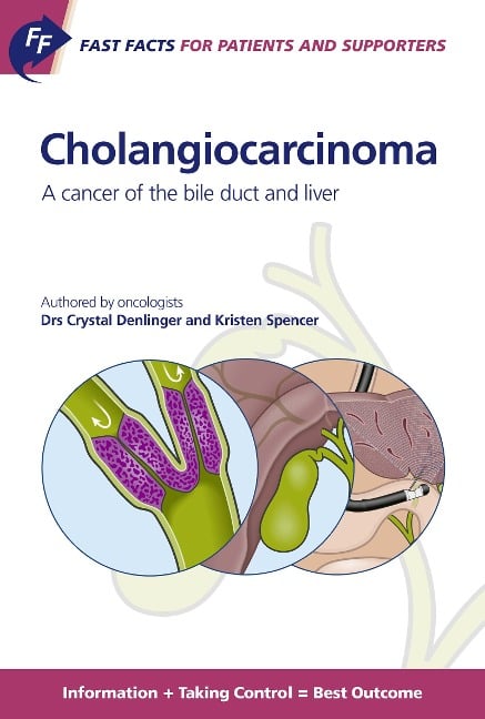 Fast Facts: Cholangiocarcinoma for Patients and their Supporters - C. Denlinger, K. Spencer