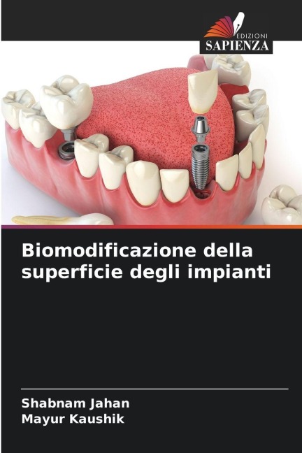 Biomodificazione della superficie degli impianti - Shabnam Jahan, Mayur Kaushik