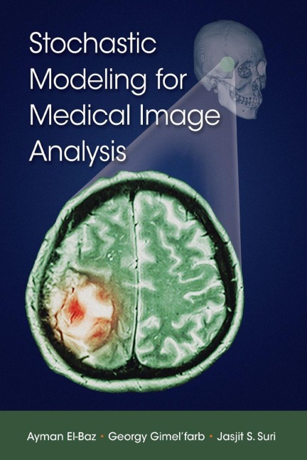 Stochastic Modeling for Medical Image Analysis - Ayman El-Baz, Georgy Gimel'Farb, Jasjit S. Suri