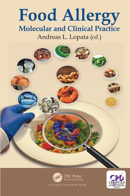 Food Allergy - 
