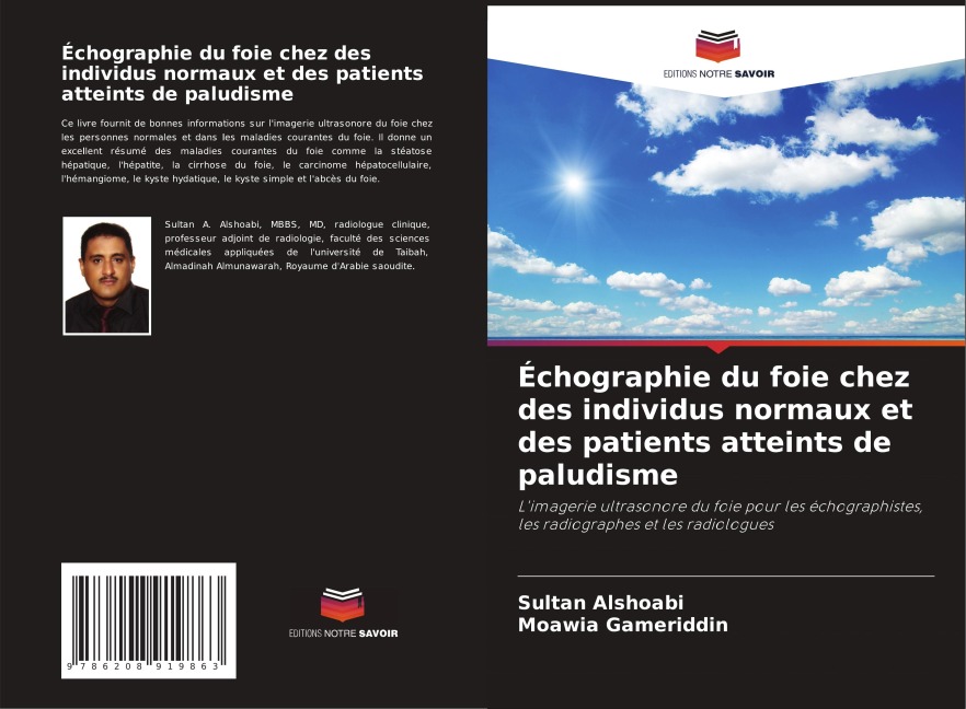 Échographie du foie chez des individus normaux et des patients atteints de paludisme - Sultan Alshoabi, Moawia Gameriddin