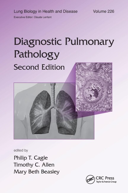 Diagnostic Pulmonary Pathology - 