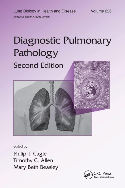 Diagnostic Pulmonary Pathology - 