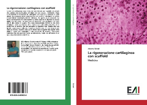 La rigenerazione cartilaginea con scaffold - Alberto Siclari