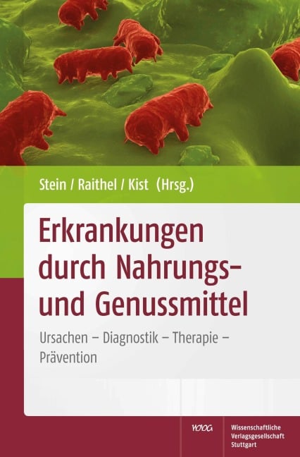 Erkrankungen durch Nahrungs- und Genussmittel - Jürgen Stein, Manfred Kist, Martin Raithel