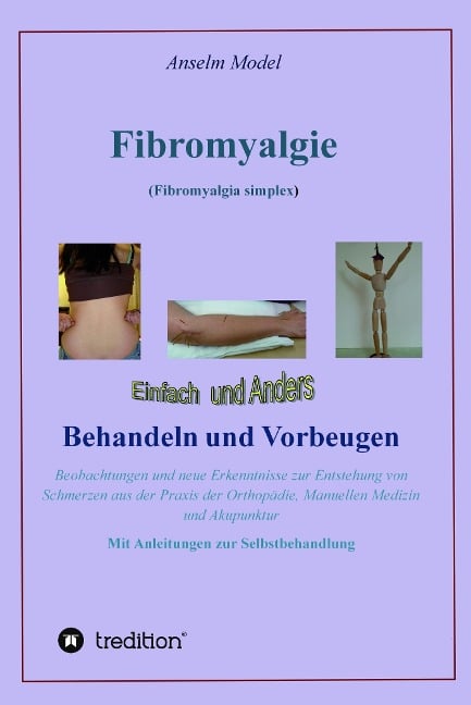 Fibromyalgie (Fibromyalgia simplex) einfach und anders behandeln und vorbeugen - Anselm Model