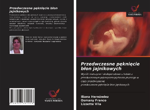 Przedwczesne p¿kni¿cie b¿on jajnikowych - Iliana Hernández, Osmany Franco, Lizzette Vila
