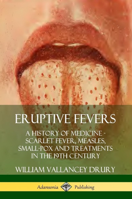 Eruptive Fevers - William Vallancey Drury