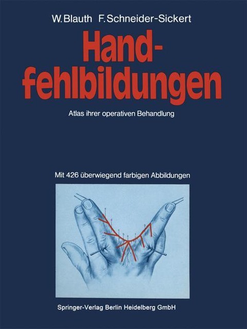 Handfehlbildungen - F. Schneider-Sickert, W. Blauth