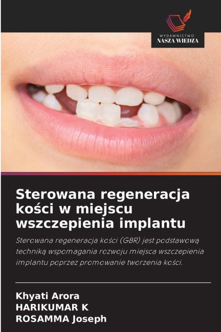 Sterowana regeneracja ko¿ci w miejscu wszczepienia implantu - Khyati Arora, Harikumar K, Rosamma Joseph