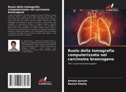Cover-Bild zum Titel 'Ruolo della tomografia computerizzata nel carcinoma broncogeno' von 'Ameet Jesrani, Nazish Khaliq'