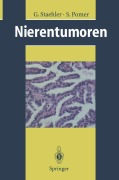 Cover-Bild zum Titel 'Nierentumoren' von 'G. Staehler, S. Pomer'
