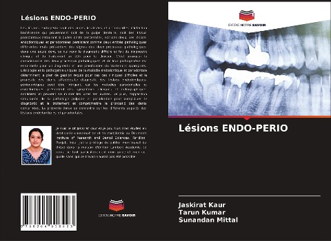 Lésions ENDO-PERIO - Jaskirat Kaur, Tarun Kumar, Sunandan Mittal