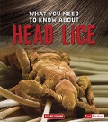 Cover-Bild zum Titel 'What You Need to Know about Head Lice' von 'Nancy Dickmann'