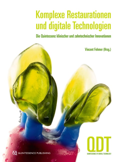 Komplexe Restaurationen und digitale Technologien - Vincent Fehmer